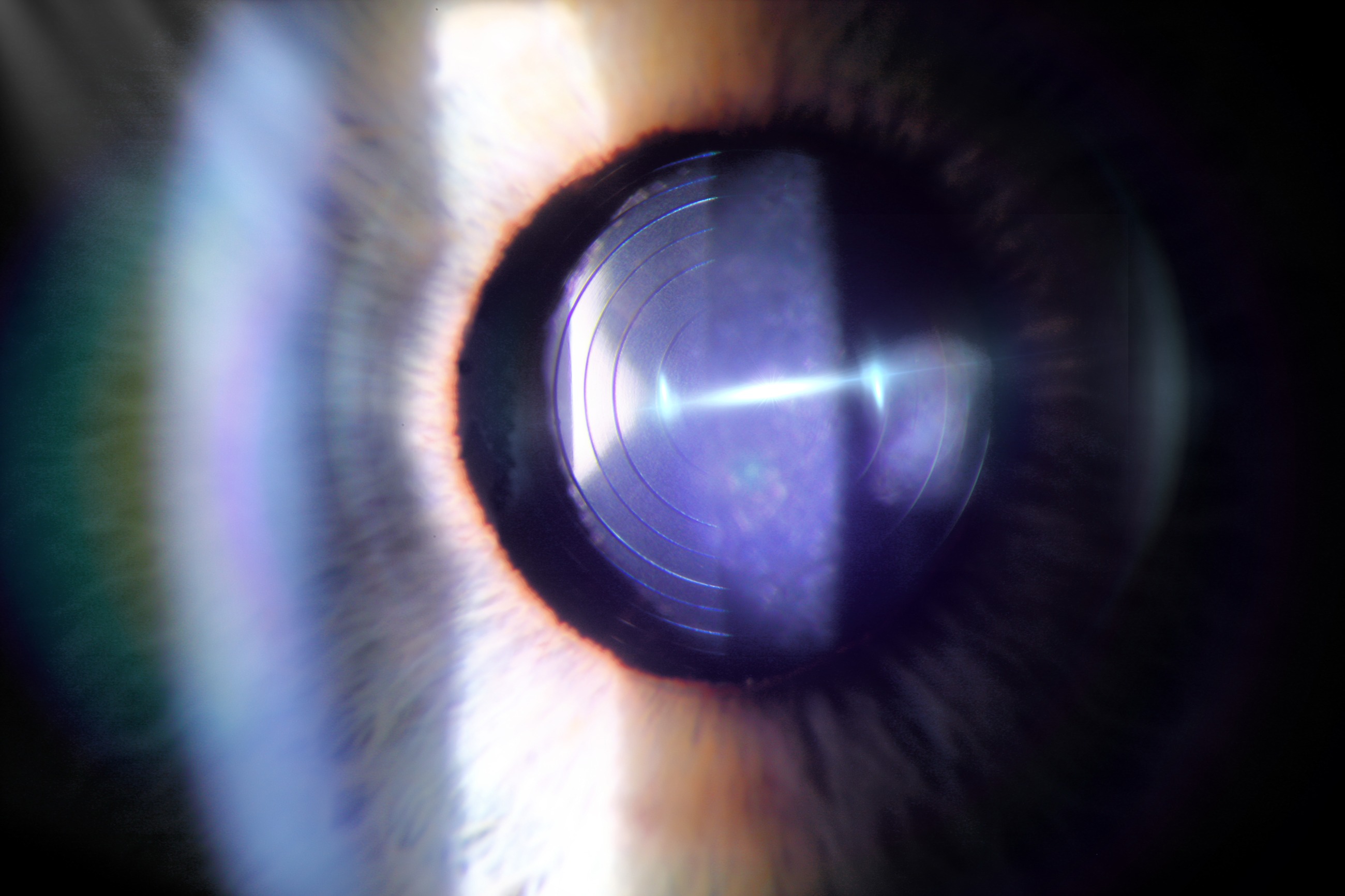Clinical eye photography